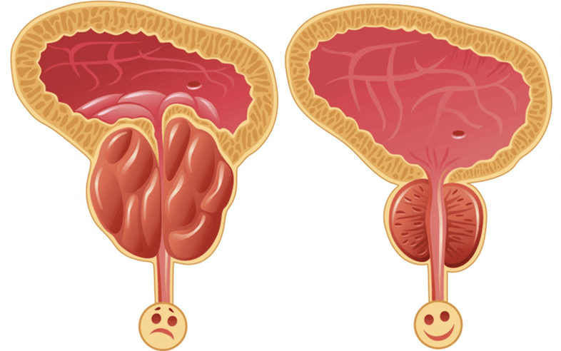 สาเหตุของปัญหาความแรงในผู้ชาย